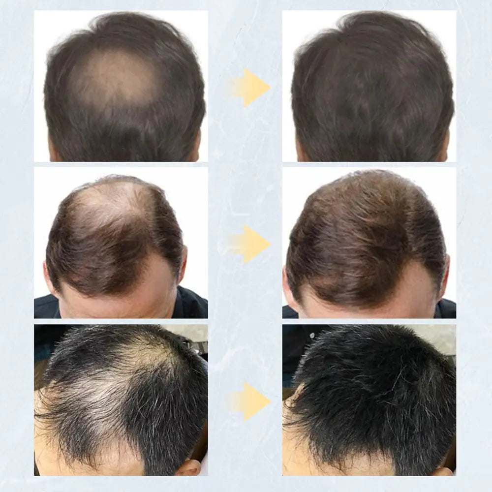 Keratin Hair Fibers